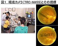 眼底カメラ（TRC-NWSS)とその視標 写真