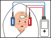 イラスト：赤ちゃんの両耳にヘッドホンを、額には電極を取り付けて検査している