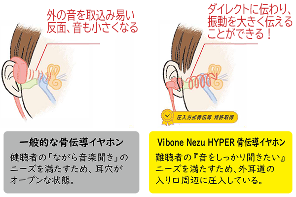 イラスト：一般的な骨伝導式と耳穴に入れるバイボーンネズハイパーの比較した耳から音が伝わる図解